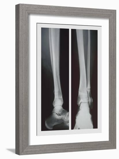 Two Ankles-null-Framed Premium Giclee Print