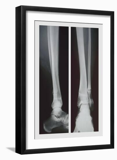 Two Ankles-null-Framed Premium Giclee Print