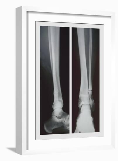 Two Ankles-null-Framed Premium Giclee Print