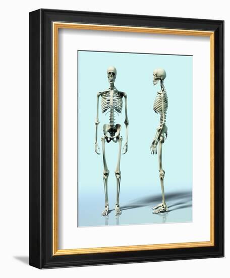 Two Skeletons-Matthias Kulka-Framed Giclee Print