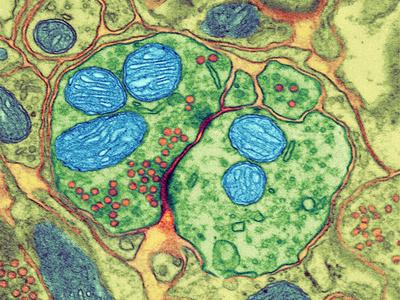 Photographic Print, , small