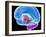 Brain Anatomy, Artwork-Roger Harris-Framed Photographic Print