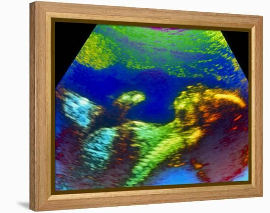 Ultrasound Scan of 20 Week Old Foetus (side View)-Science Photo Library-Framed Premier Image Canvas