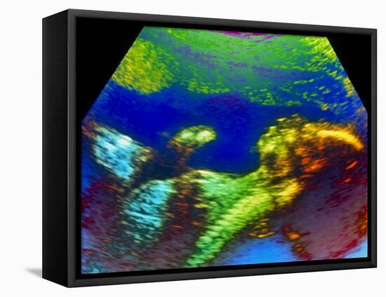 Ultrasound Scan of 20 Week Old Foetus (side View)-Science Photo Library-Framed Premier Image Canvas