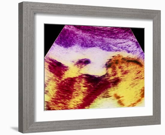 Ultrasound Scan of 20 Week Old Foetus (side View)-Science Photo Library-Framed Photographic Print