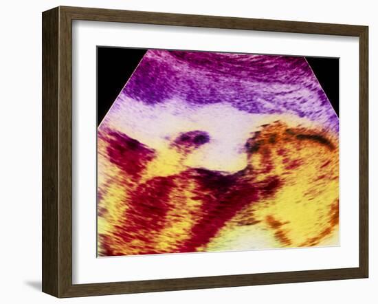 Ultrasound Scan of 20 Week Old Foetus (side View)-Science Photo Library-Framed Photographic Print