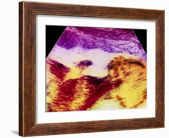 Ultrasound Scan of 20 Week Old Foetus (side View)-Science Photo Library-Framed Photographic Print