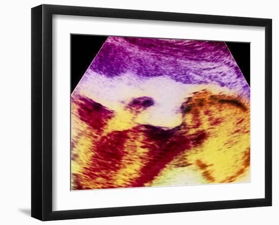 Ultrasound Scan of 20 Week Old Foetus (side View)-Science Photo Library-Framed Photographic Print