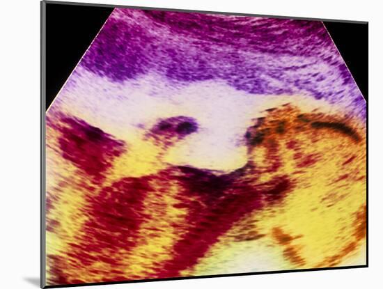 Ultrasound Scan of 20 Week Old Foetus (side View)-Science Photo Library-Mounted Photographic Print