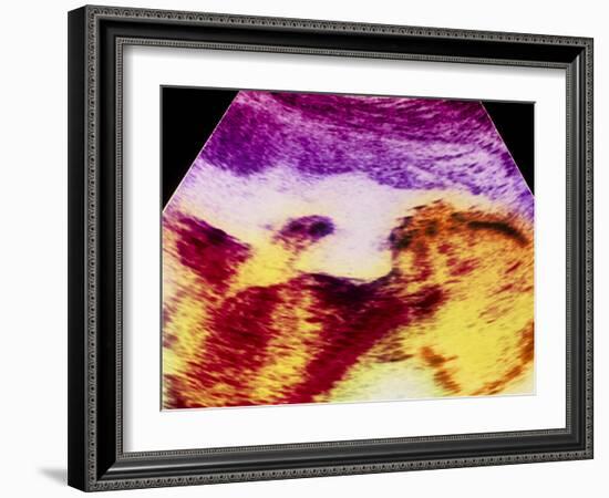 Ultrasound Scan of 20 Week Old Foetus (side View)-Science Photo Library-Framed Photographic Print