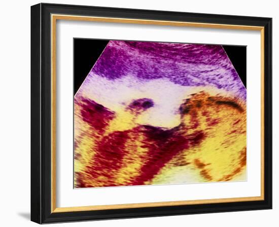 Ultrasound Scan of 20 Week Old Foetus (side View)-Science Photo Library-Framed Photographic Print