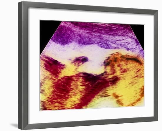 Ultrasound Scan of 20 Week Old Foetus (side View)-Science Photo Library-Framed Photographic Print