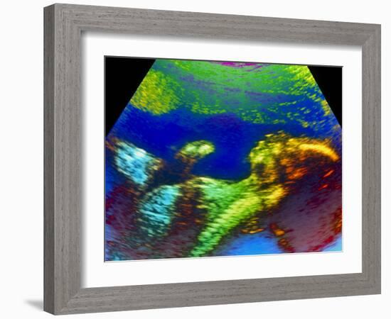 Ultrasound Scan of 20 Week Old Foetus (side View)-Science Photo Library-Framed Photographic Print