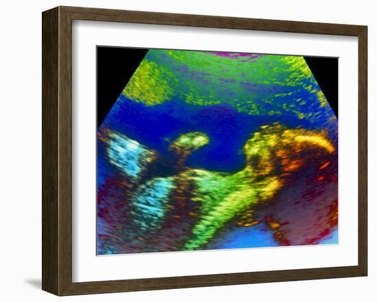 Ultrasound Scan of 20 Week Old Foetus (side View)-Science Photo Library-Framed Photographic Print