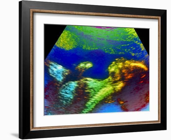 Ultrasound Scan of 20 Week Old Foetus (side View)-Science Photo Library-Framed Photographic Print