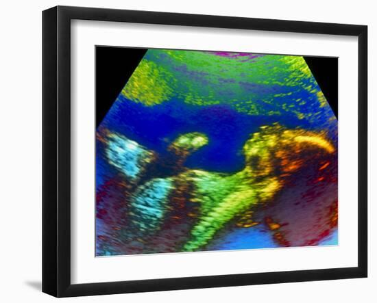 Ultrasound Scan of 20 Week Old Foetus (side View)-Science Photo Library-Framed Photographic Print