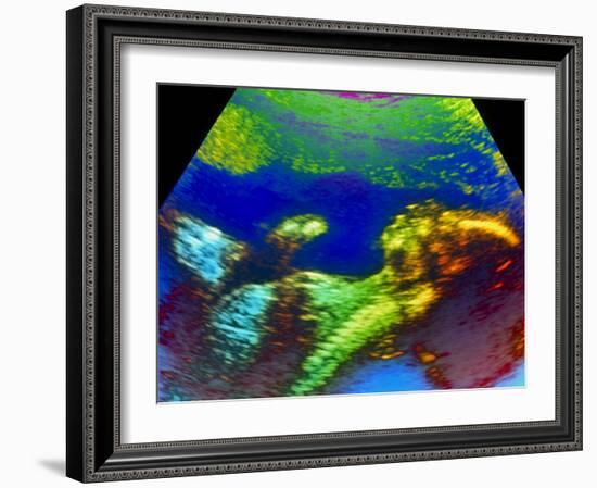 Ultrasound Scan of 20 Week Old Foetus (side View)-Science Photo Library-Framed Photographic Print