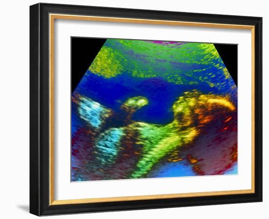 Ultrasound Scan of 20 Week Old Foetus (side View)-Science Photo Library-Framed Photographic Print