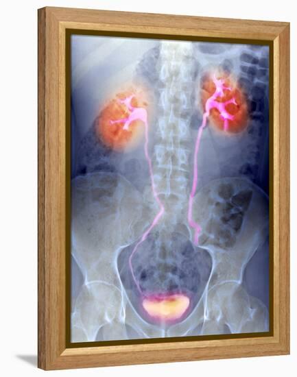 Urinary System, X-ray-Du Cane Medical-Framed Premier Image Canvas