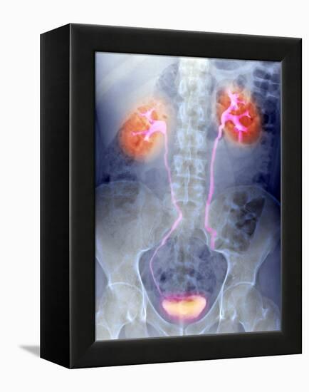 Urinary System, X-ray-Du Cane Medical-Framed Premier Image Canvas