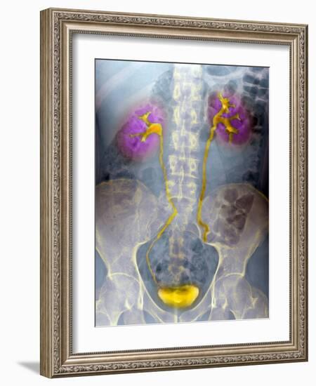 Urinary System, X-ray-Du Cane Medical-Framed Photographic Print