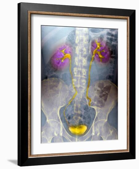 Urinary System, X-ray-Du Cane Medical-Framed Photographic Print