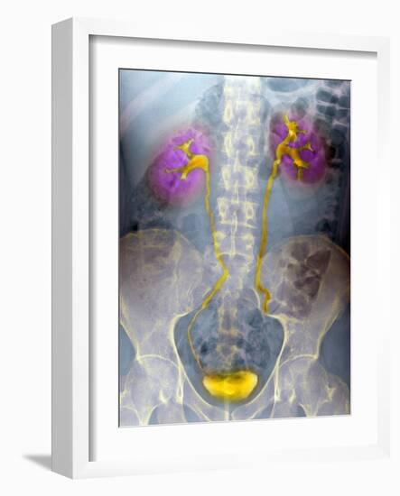 Urinary System, X-ray-Du Cane Medical-Framed Photographic Print