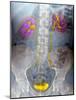 Urinary System, X-ray-Du Cane Medical-Mounted Photographic Print