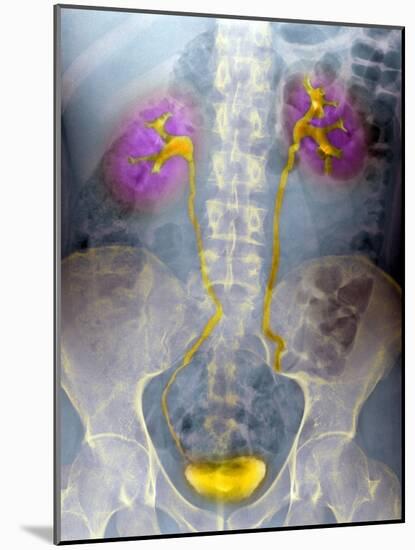 Urinary System, X-ray-Du Cane Medical-Mounted Photographic Print