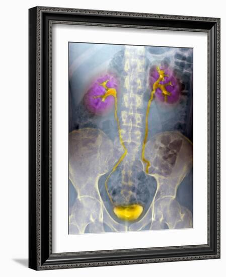 Urinary System, X-ray-Du Cane Medical-Framed Photographic Print