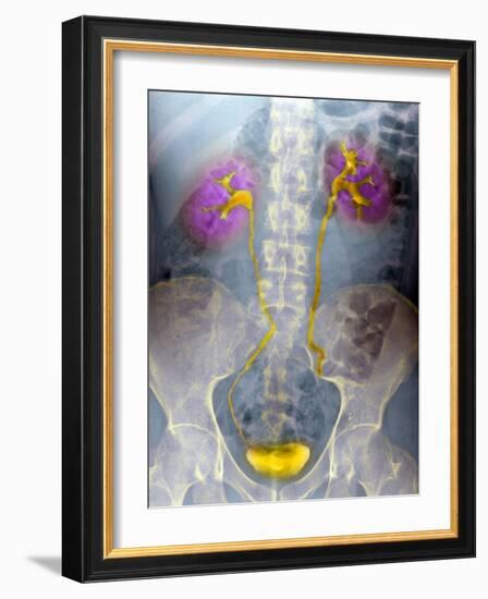 Urinary System, X-ray-Du Cane Medical-Framed Photographic Print