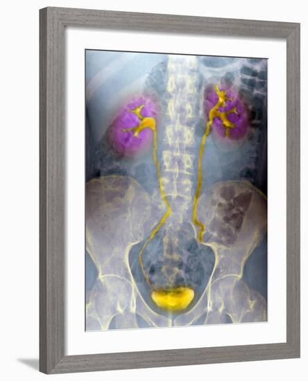 Urinary System, X-ray-Du Cane Medical-Framed Photographic Print