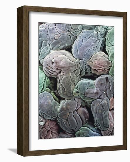 Uterine Lining, SEM-Steve Gschmeissner-Framed Photographic Print