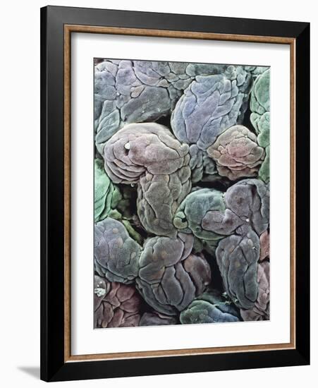 Uterine Lining, SEM-Steve Gschmeissner-Framed Photographic Print