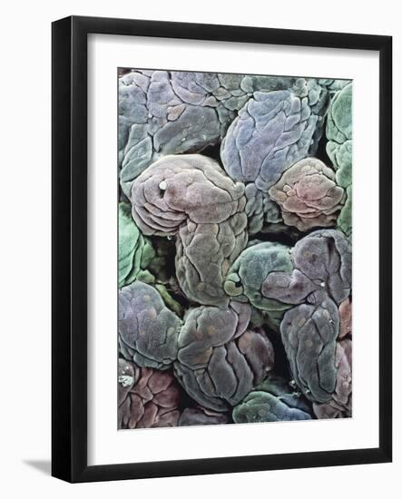 Uterine Lining, SEM-Steve Gschmeissner-Framed Photographic Print