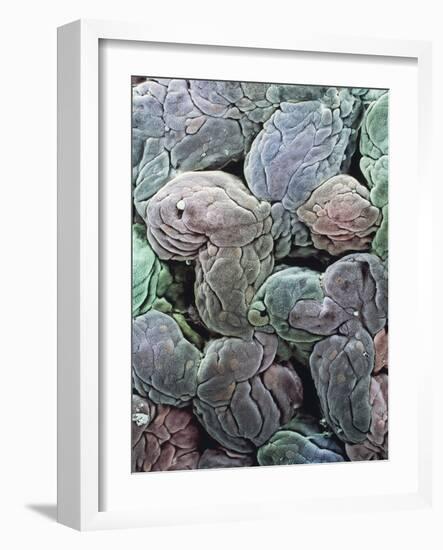 Uterine Lining, SEM-Steve Gschmeissner-Framed Photographic Print