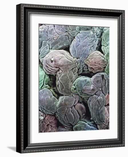 Uterine Lining, SEM-Steve Gschmeissner-Framed Photographic Print