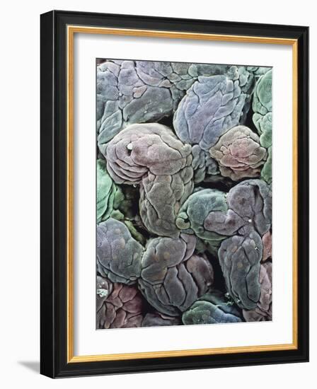 Uterine Lining, SEM-Steve Gschmeissner-Framed Photographic Print