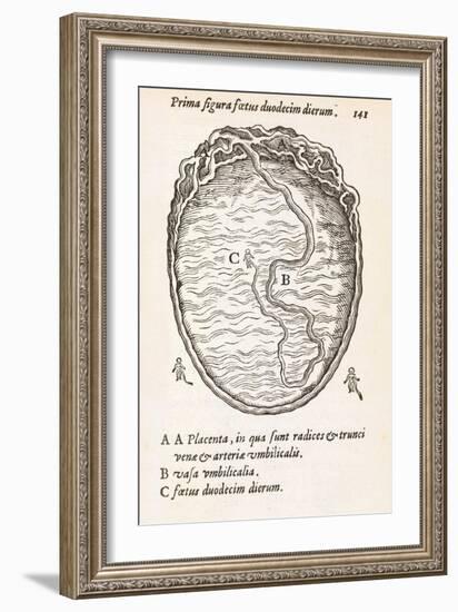 Uterus And Embryo, 16th Century-Middle Temple Library-Framed Photographic Print