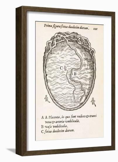 Uterus And Embryo, 16th Century-Middle Temple Library-Framed Photographic Print