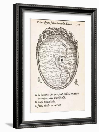 Uterus And Embryo, 16th Century-Middle Temple Library-Framed Photographic Print