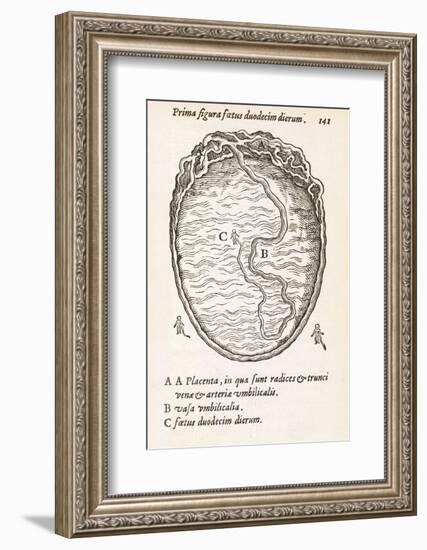 Uterus And Embryo, 16th Century-Middle Temple Library-Framed Photographic Print