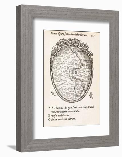 Uterus And Embryo, 16th Century-Middle Temple Library-Framed Photographic Print