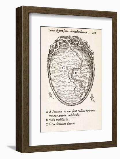 Uterus And Embryo, 16th Century-Middle Temple Library-Framed Photographic Print