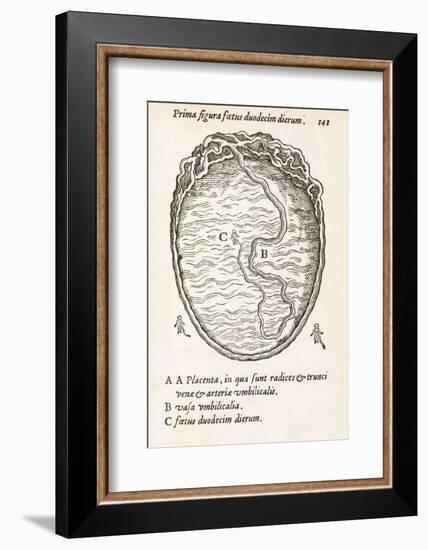 Uterus And Embryo, 16th Century-Middle Temple Library-Framed Photographic Print