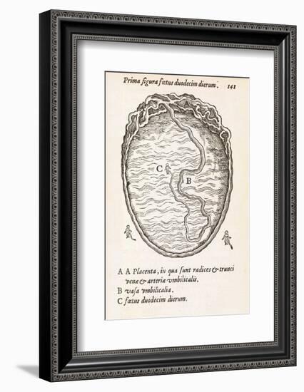 Uterus And Embryo, 16th Century-Middle Temple Library-Framed Photographic Print