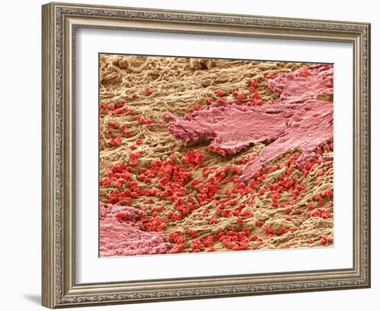 Uterus Lining During Menstruation, SEM-Steve Gschmeissner-Framed Photographic Print