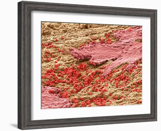 Uterus Lining During Menstruation, SEM-Steve Gschmeissner-Framed Photographic Print