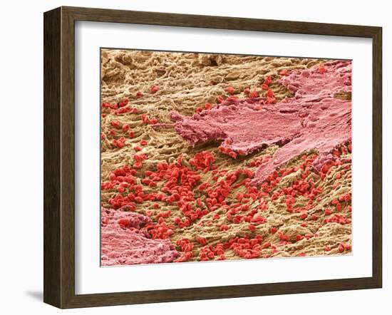 Uterus Lining During Menstruation, SEM-Steve Gschmeissner-Framed Photographic Print