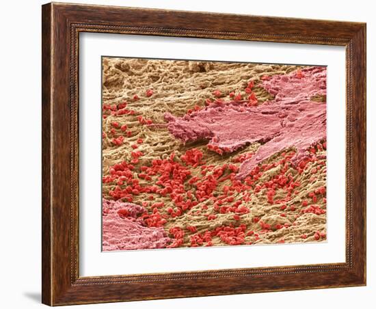 Uterus Lining During Menstruation, SEM-Steve Gschmeissner-Framed Photographic Print